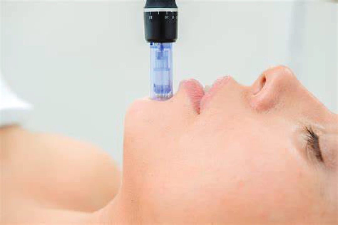 MICRONEEDLING