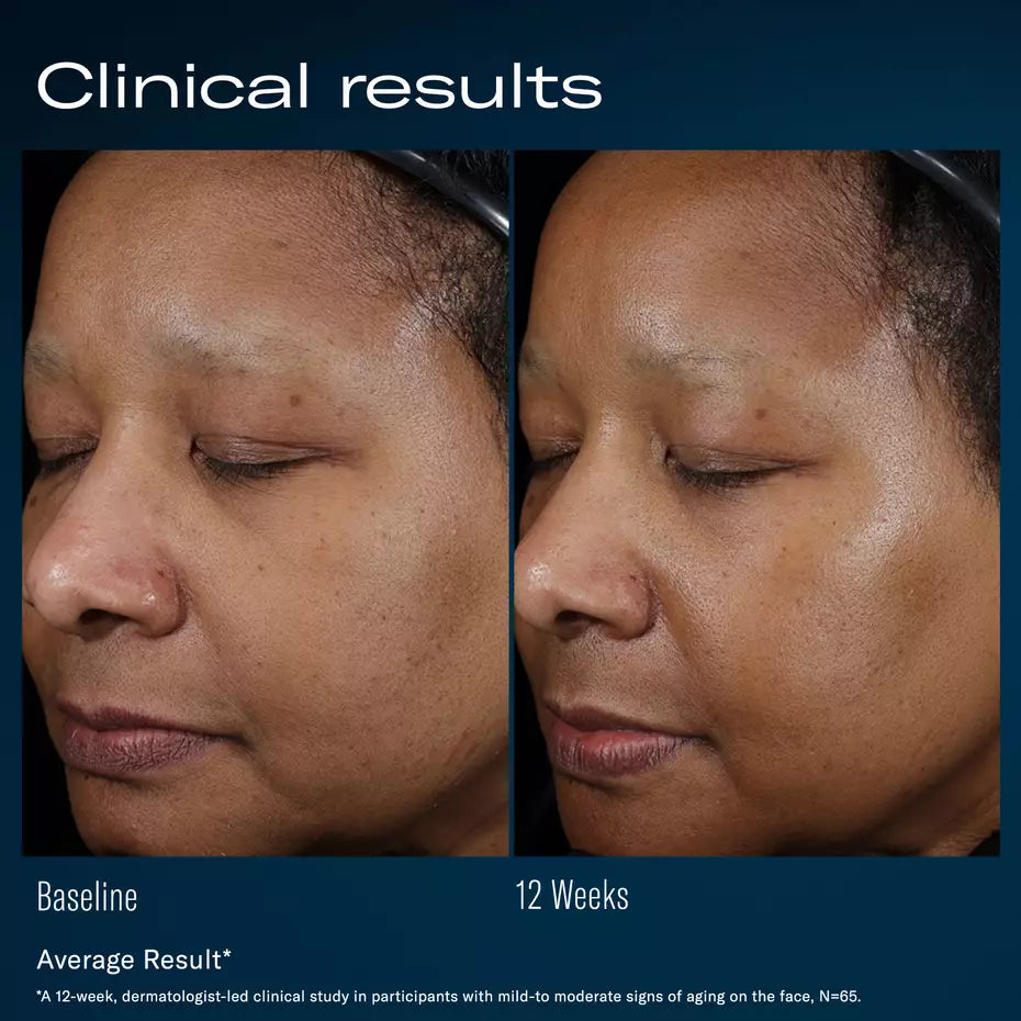 Ampra volumizing macro HA serum