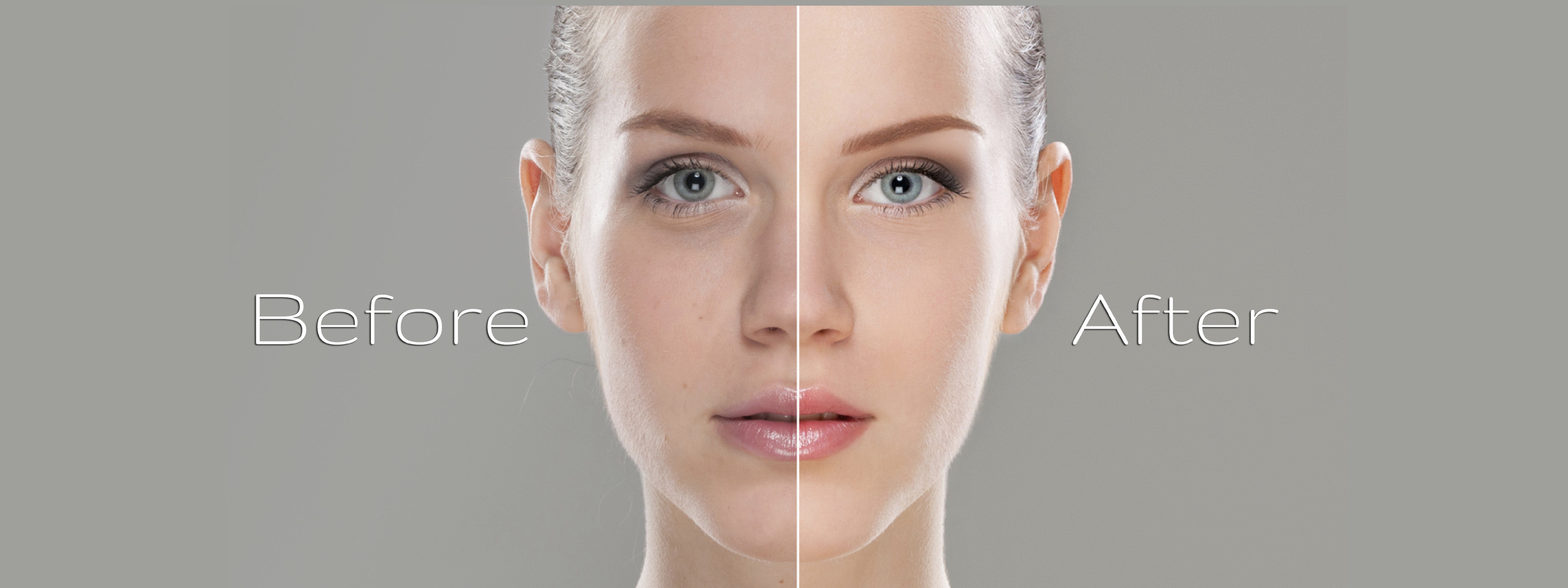 files/Before_After-01.jpg