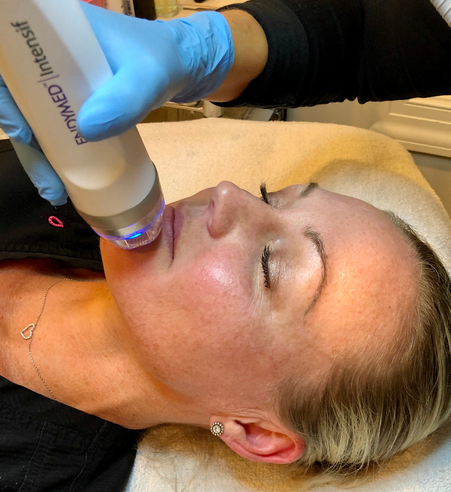 The most advanced RF microneedling.