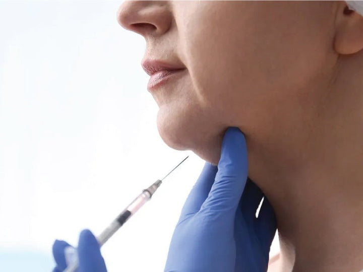 Lipolysis