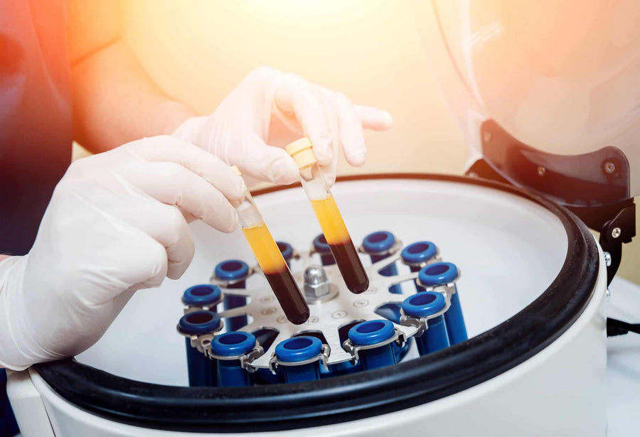 Your own platelets do the repair work