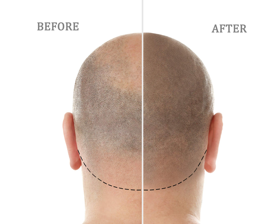 Dots that read as the shadow of shaved hair
