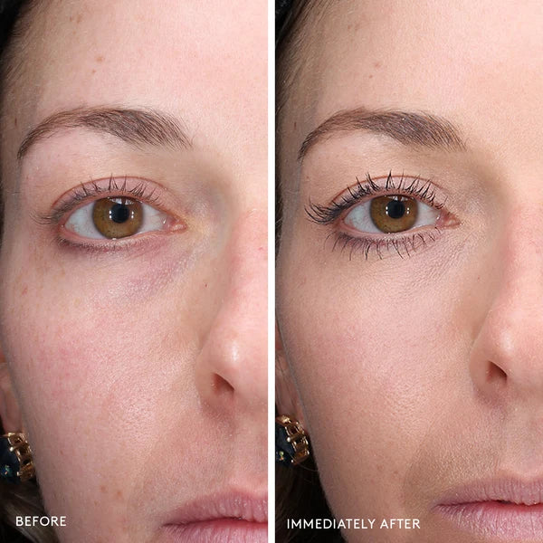 Total eye 3 in 1 renewal care