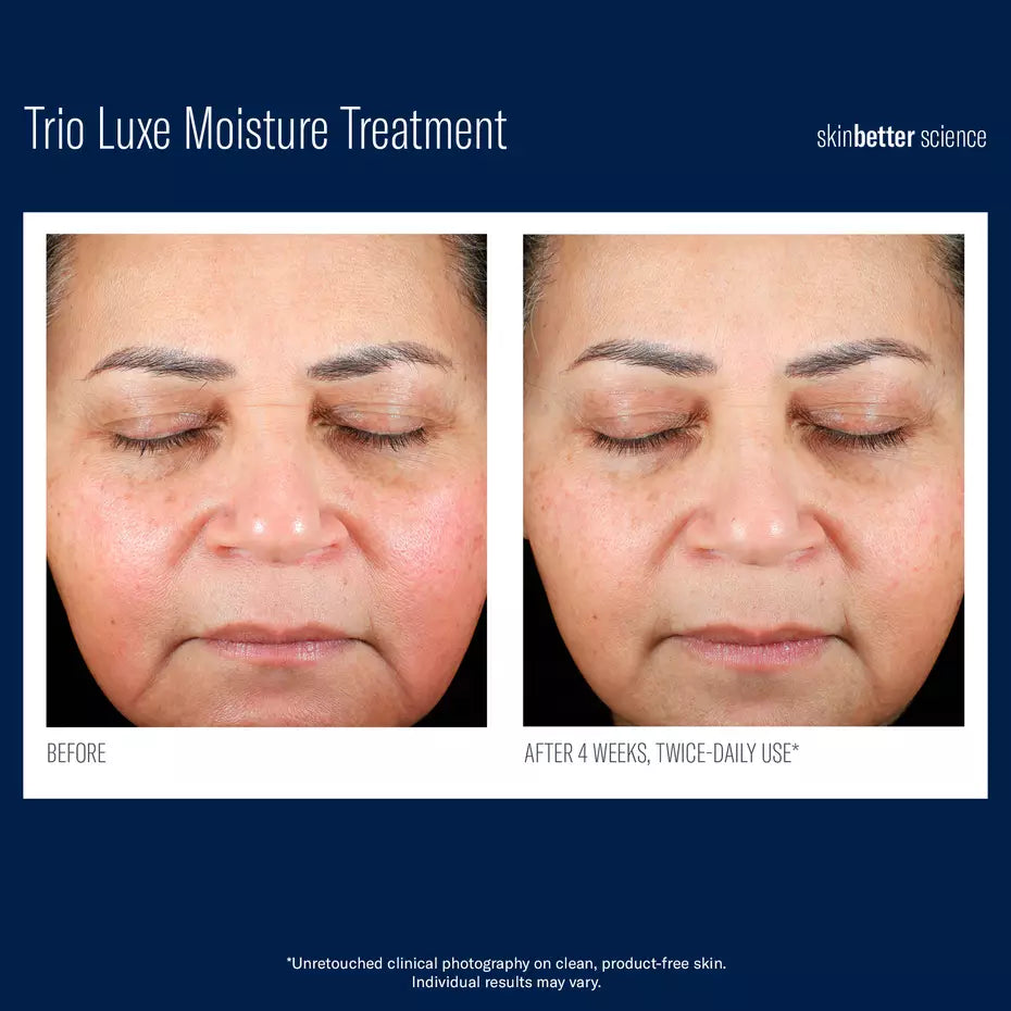Trio Luxe moisture treatment