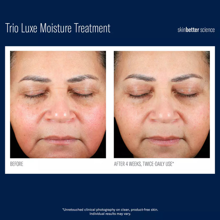 Trio Luxe moisture treatment