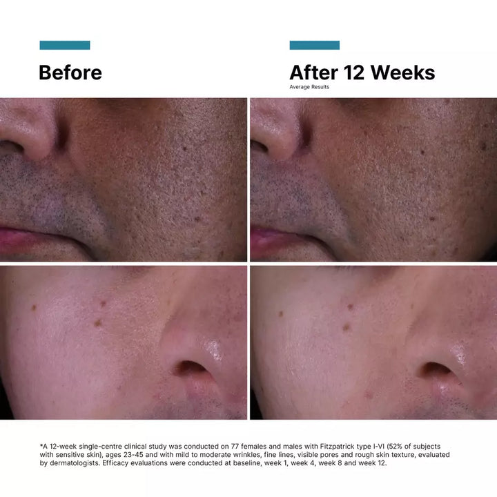 P-TIOX Anti-Wrinkle Cream