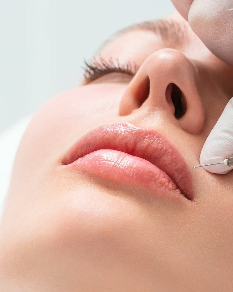 Lip filler at Lucie Mé