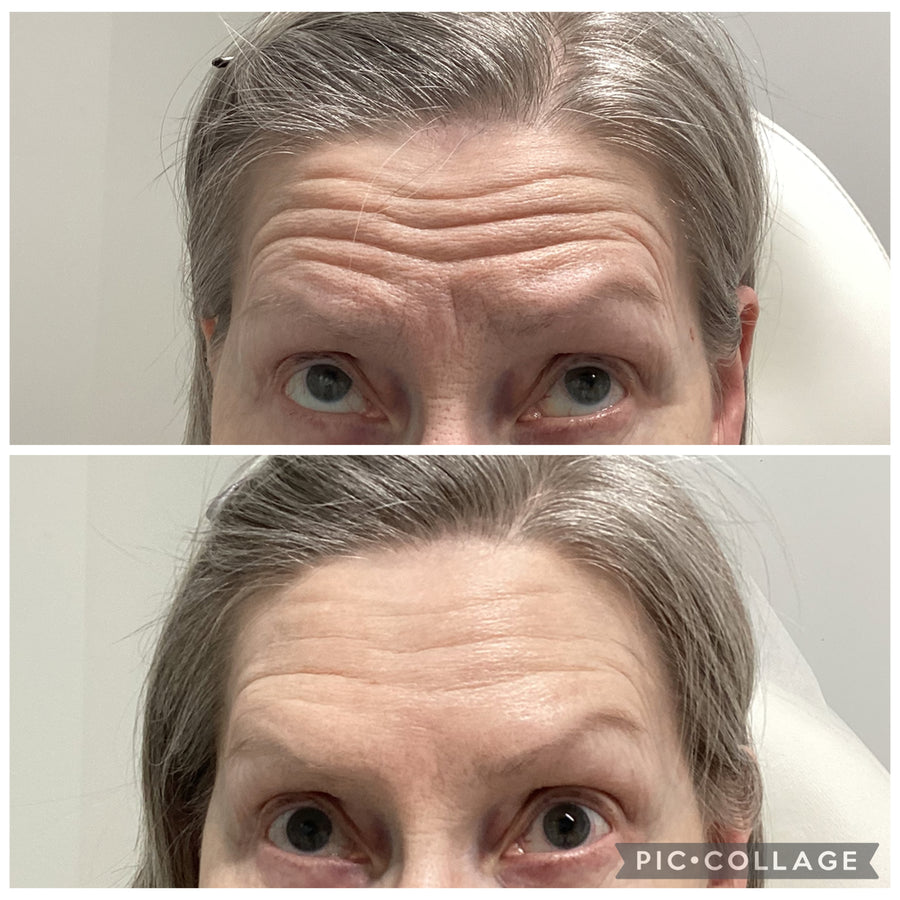 Before and after results