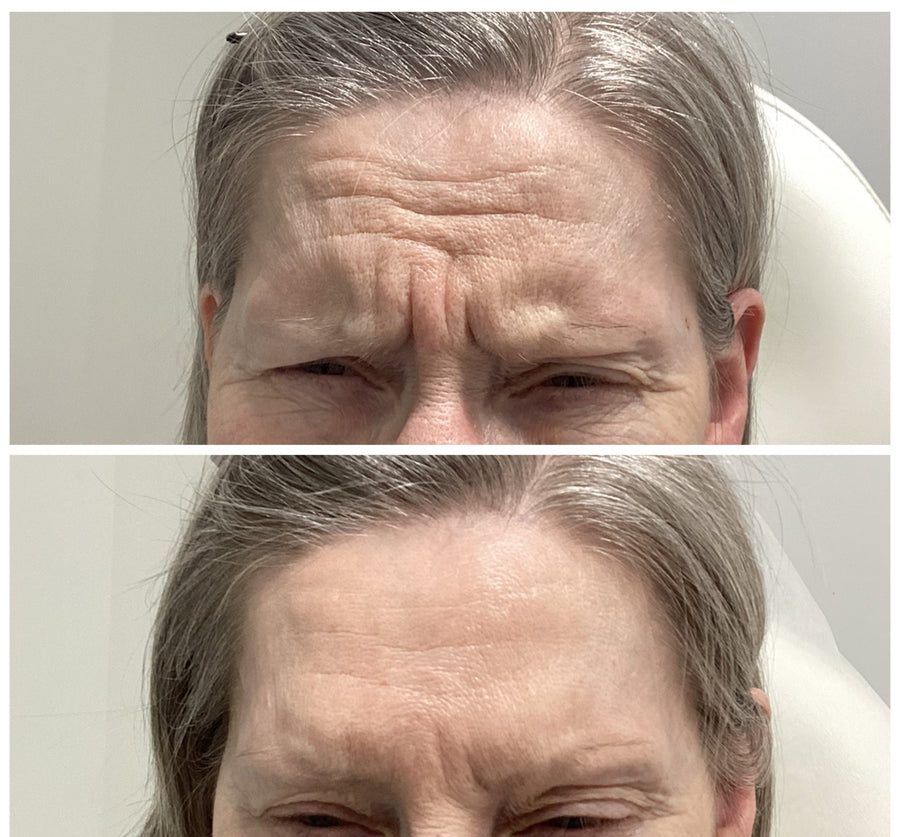 Before and after results