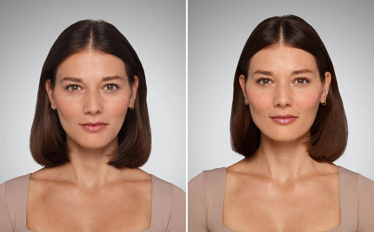Lip Enhancement