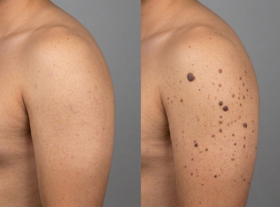 Before and after results