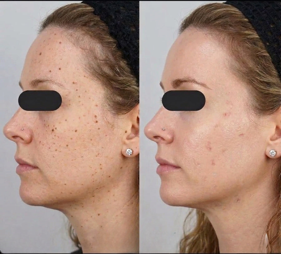 Before and after results