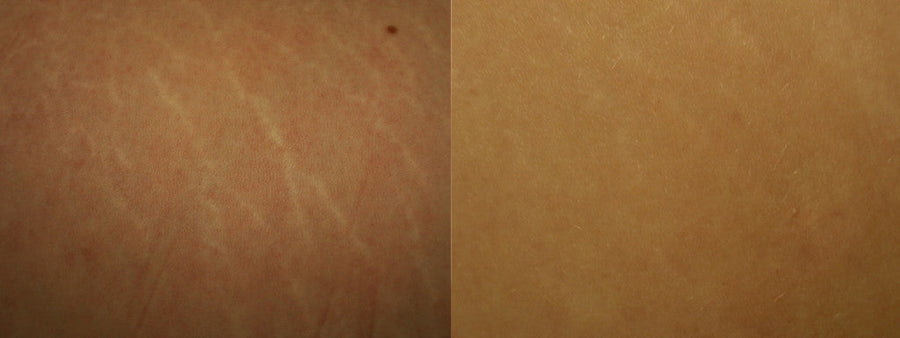 Before and after results