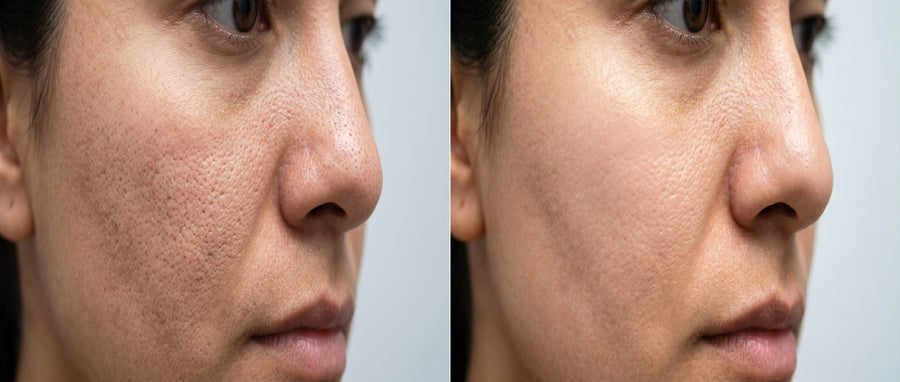 Before and after results